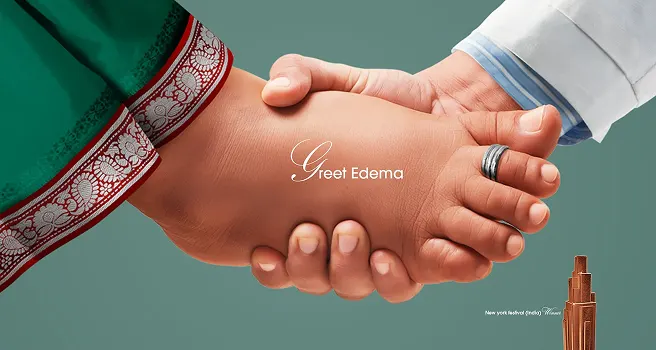 Healthcare campaign visual showing a doctor examining pedal edema through physical assessment in a clinical setting
