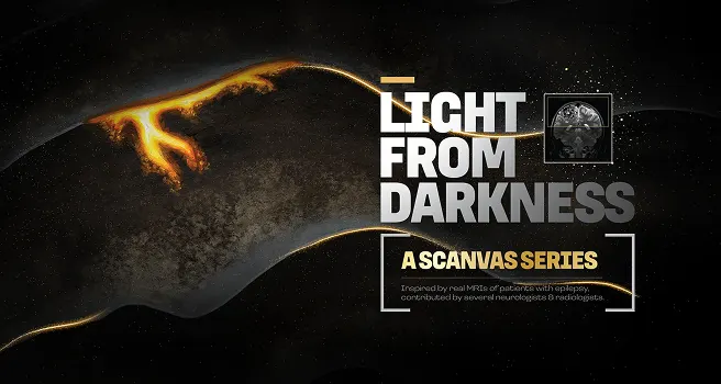 Epilepsy awareness campaign using MRI-inspired visuals to depict neurological conditions and healthcare storytelling